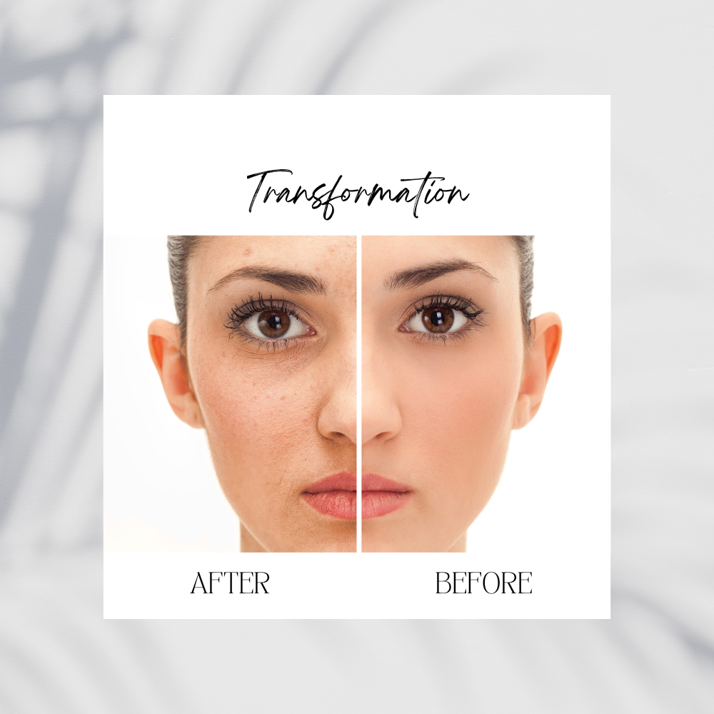 Clarifying Cleanser Salicylic Acid 2% Acne Treatment - Image 2