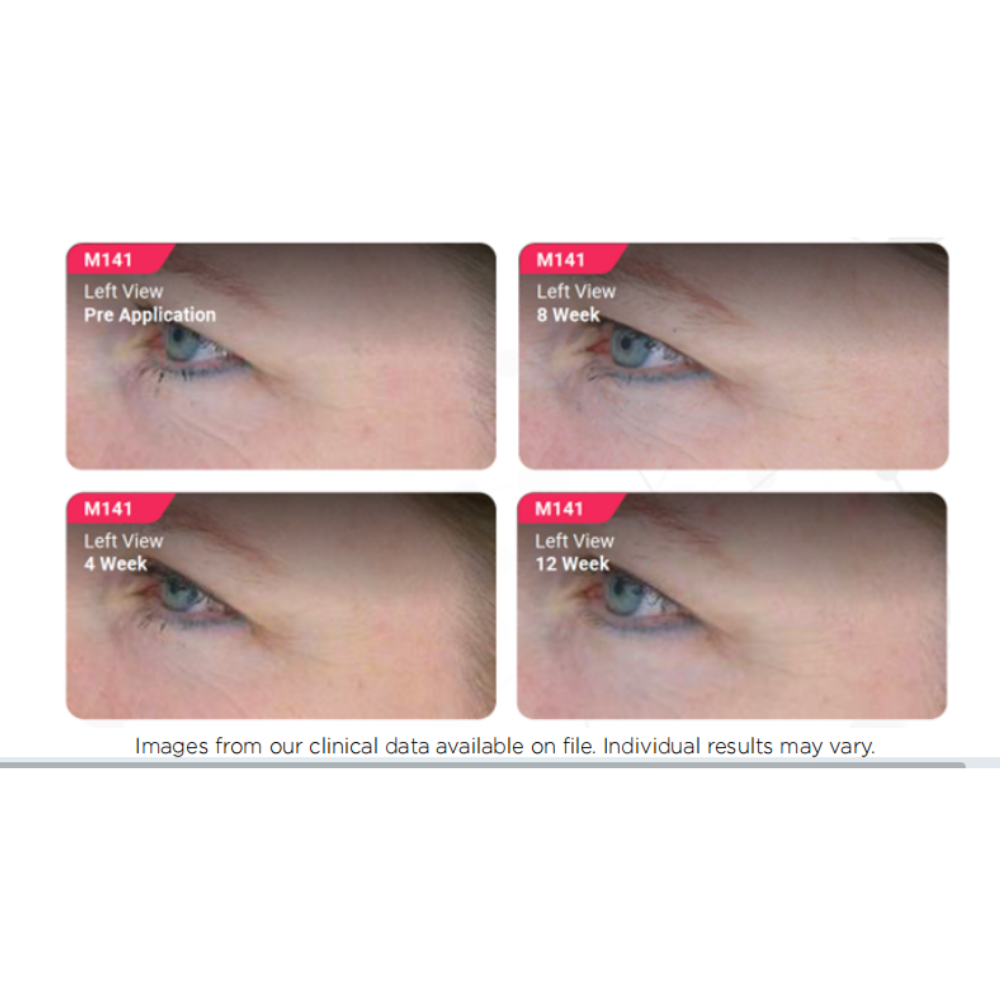 Advanced Ret10X + Bakuchiol Serum - Image 3