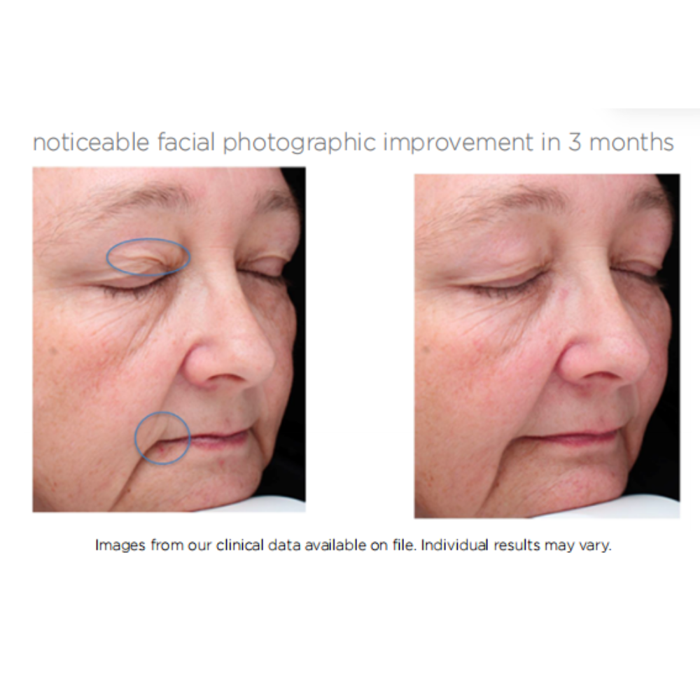 Advanced Ret10X + Bakuchiol Serum - Image 2